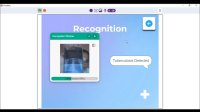 Radia AI _ Codeavour 2022 Project by Sindhoora R and Vedanth Raja 7-6 screenshot